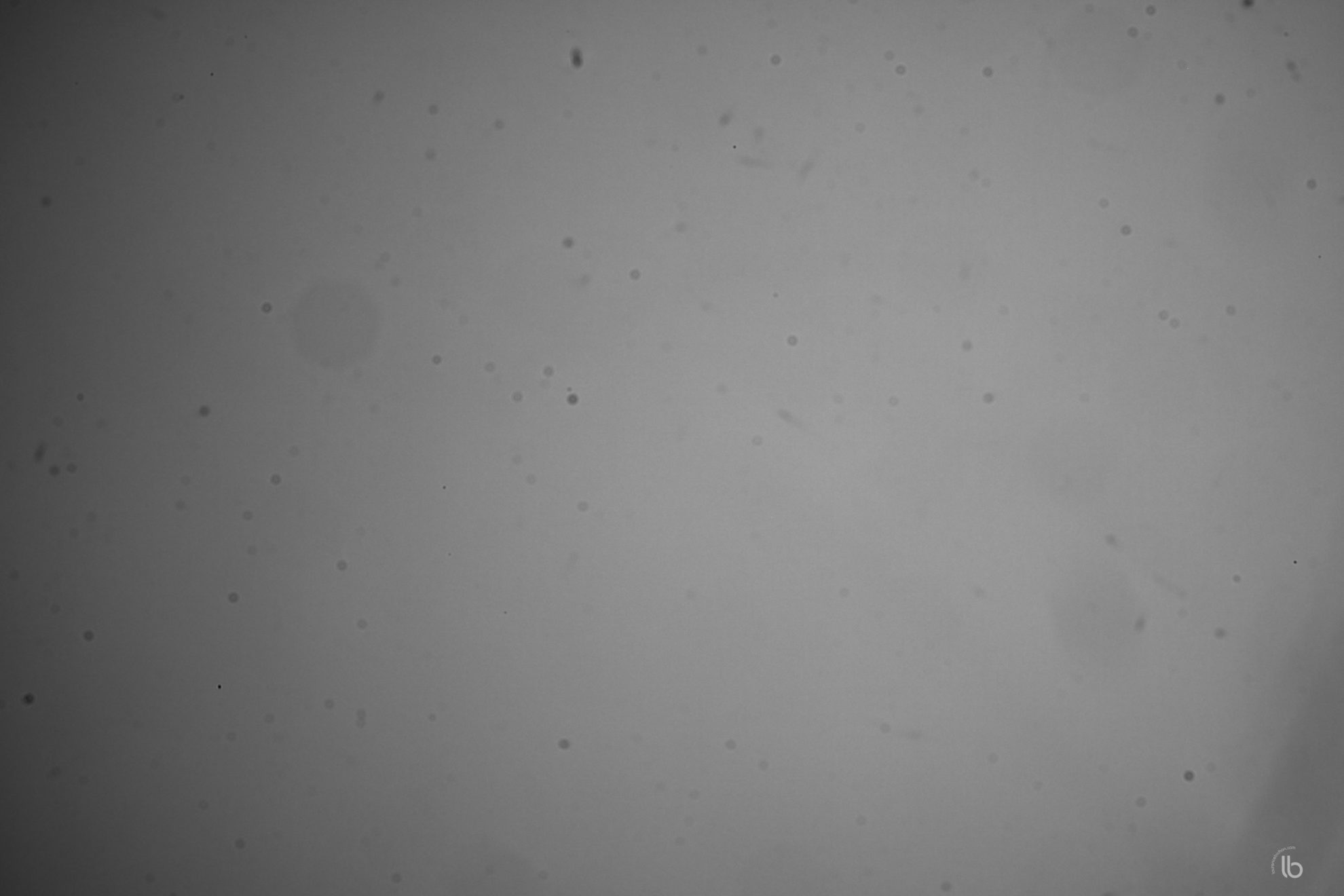 How to Clean Dust from a Fujifilm Mirrorless Camera GUIDE]